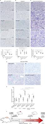 A Conformational Change in C-Reactive Protein Enhances Leukocyte Recruitment and <mark class="highlighted">Reactive Oxygen Species Generation</mark> in Ischemia/Reperfusion Injury